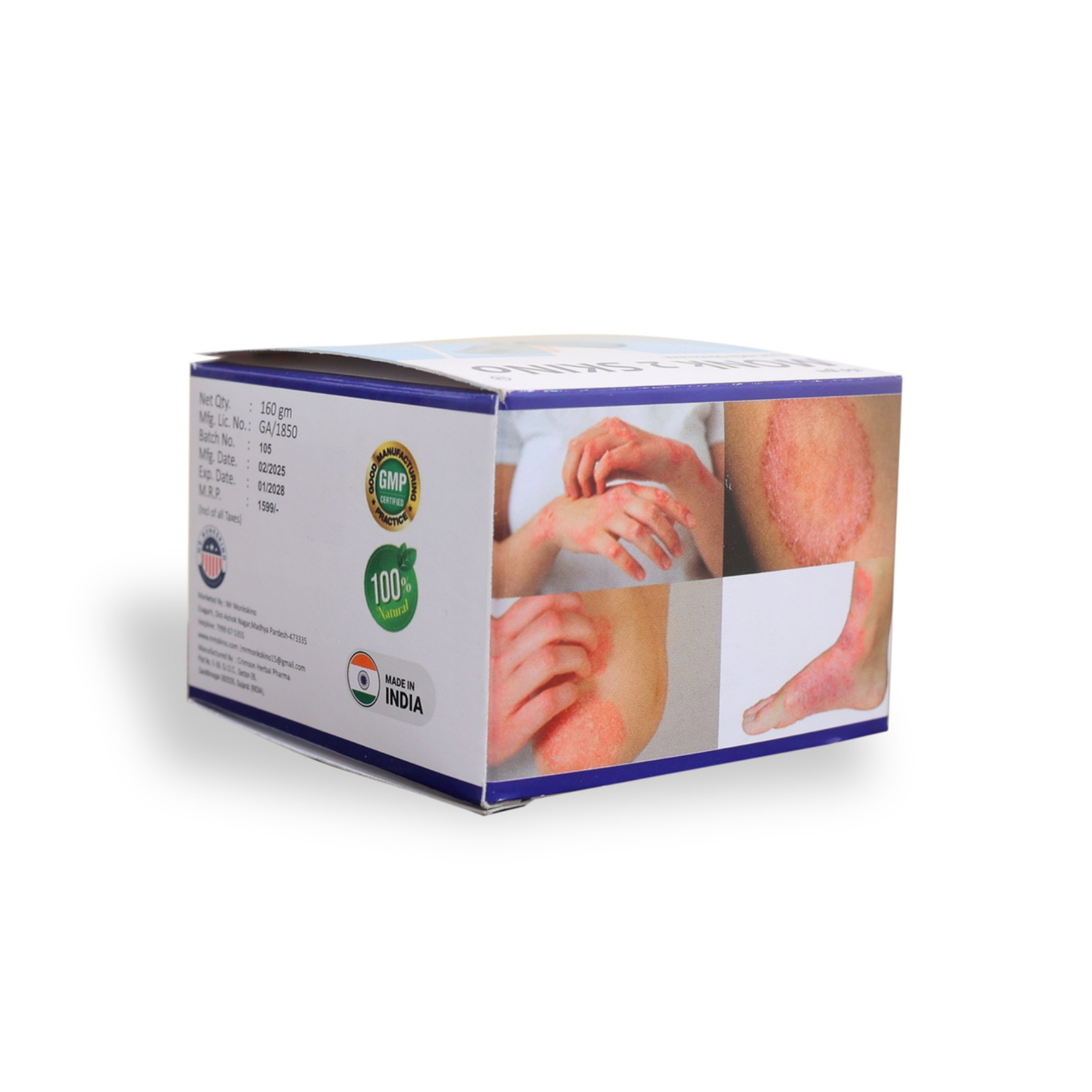 MONk 2 SKINo Ayurvedic Malham for Ringworm and Itching